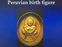 Peruvian brass casting depicting the traditional way of aiding birth by Birth Canal Widening using 4 fingers of both hands pulling away from the centre.jpg