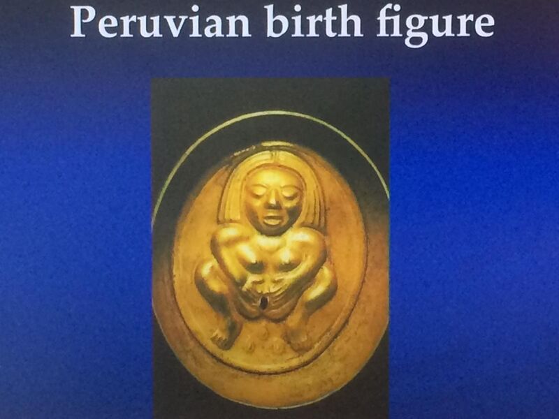 File:Peruvian brass casting depicting the traditional way of aiding birth by Birth Canal Widening using 4 fingers of both hands pulling away from the centre.jpg