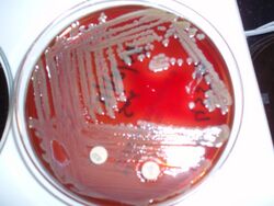 Elizabethkingia meningoseptica on a blood agar plate