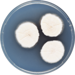 Aspergillus neoechinulatus cya.png