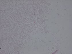 Pantoea agglomerans.jpg