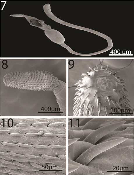 File:Parasite170077-fig 07-11 Neoandracantha peruensis (Acanthocephala).png