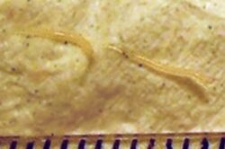 Pinworms ("Enterobius vermicularis")