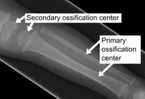 X-ray of ossification centers.png