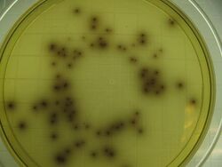 Listeria monocytogenes grown on Listeria Selective Agar.jpg