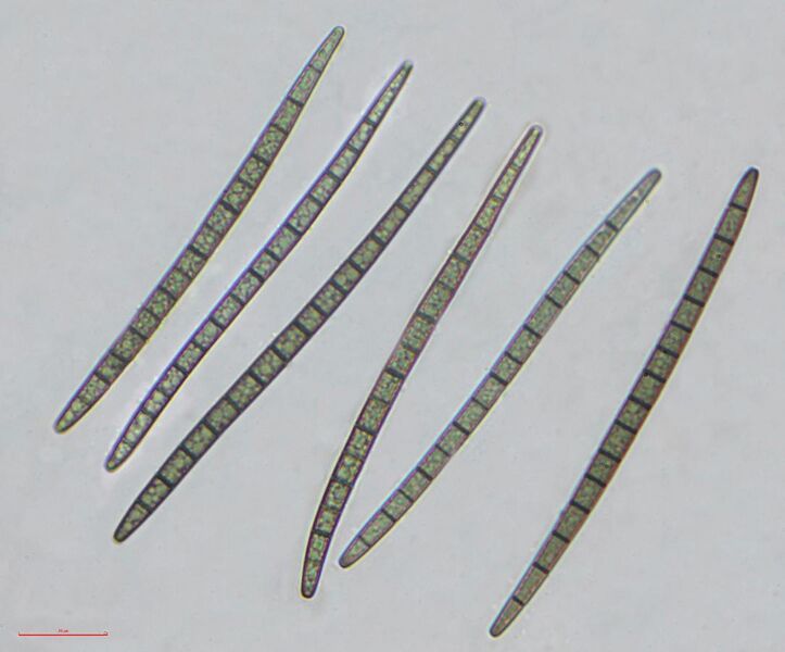 File:Trichoglossum hirsutum.brightfield-400x.jpg