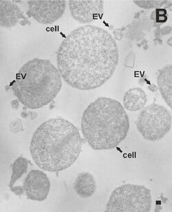 Acholeplasma laidlawii PG8 Cells and EVs (cropped).jpg