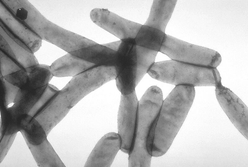 File:Legionella pneumophila 01.jpg
