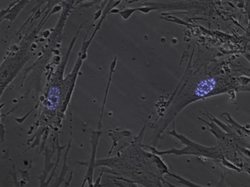 HEL cells + PML3 eCFP.png