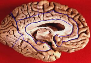 Human brain inferior-medial view description.JPG