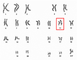 Human male karyotpe high resolution - Chromosome 11.png