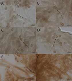 Hypochnus rhacodium (10.3897-mycokeys.50.32432) Figure 21.jpg