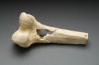 Femur bone with a hole caused by a bullet
