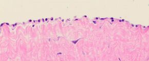 Histology of the mesothelial lining of a hernia sac.jpg
