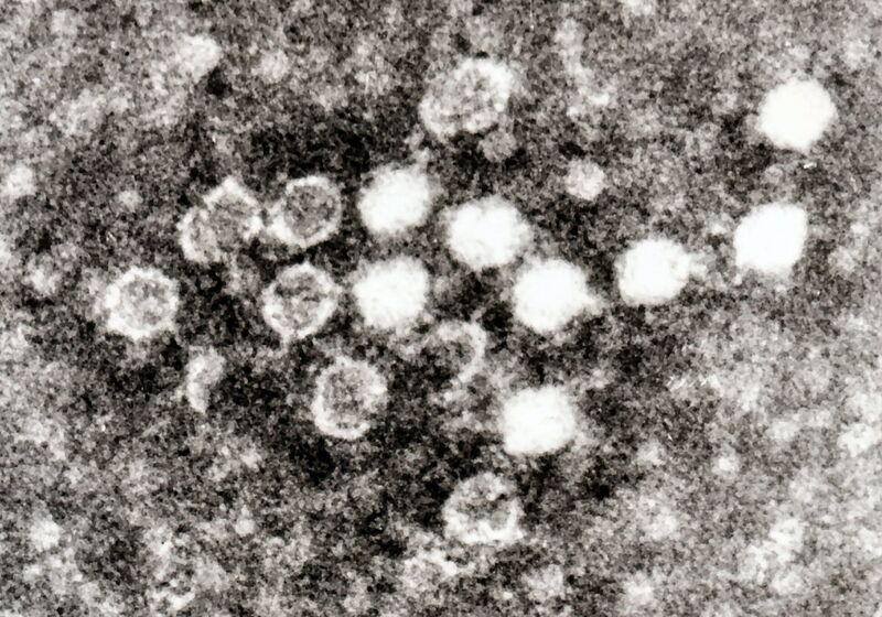 File:Parvovirus in Blood.jpg