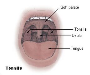 Tonsils diagram.jpg