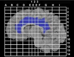Cingulate region of human brain.jpg