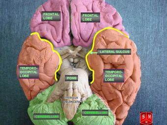 Inferior view of brain.