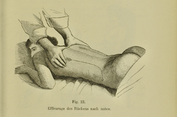 Effleurage des Rückens nach unten,extracted from Die Technik der Massage (1898).png