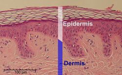 Epidermis-delimited.JPG