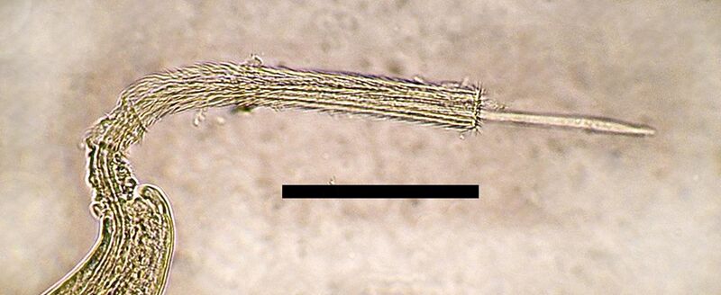 File:Eucoleus aerophilus male spicule.jpg