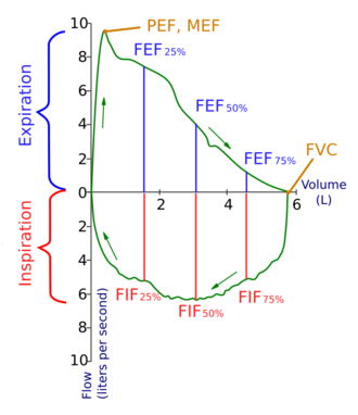 Flow-volume-loop.svg