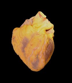 Human heart male adult autopsy.jpg