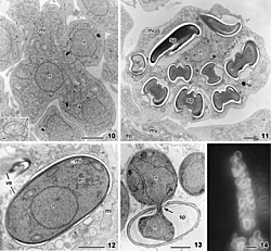 Nephridiophaga blattellae (10.3897-mycokeys.25.12446) Figures 10–14.jpg