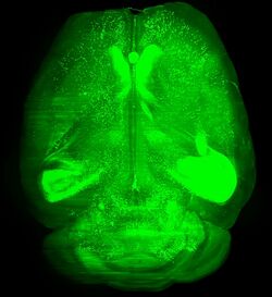 3DISCO imaging of mouse brain.jpg