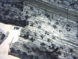 Microscopic view of a layer of translucent grayish cells, some containing small dark-color spheres