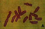 Karyotype of Broad bean (Vicia faba).png