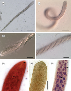 Parasite160090-fig1 Cepedea longa (Opalinidae).png