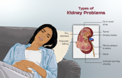 Depiction of types of kidney disease.png