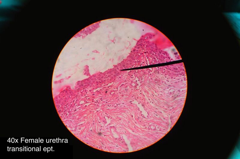 File:Female urethra histology.jpg
