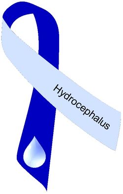 Hydrocephalus ribbon two tone blue.jpg