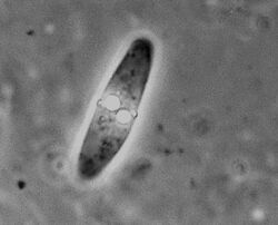 Myxobolus spinacurvatura.jpg
