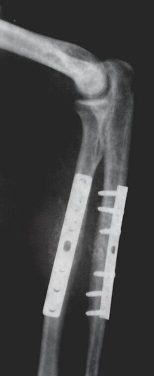 X-ray3.jpg