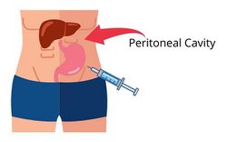 Peritoneal Cavity Human1.jpg