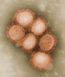 CDC-11214-swine-flu.jpg