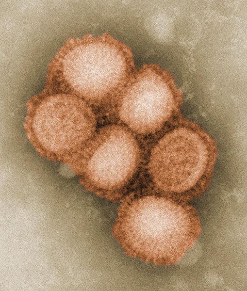 File:CDC-11214-swine-flu.jpg