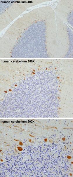 File:PCP4 immunohistochemistry in human cerebellum.jpg
