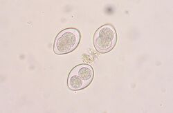 Coccidia oocysts in a fecal flotation from a cat. The cat was underweight and had diarrhea, showing signs of coccidiosis.