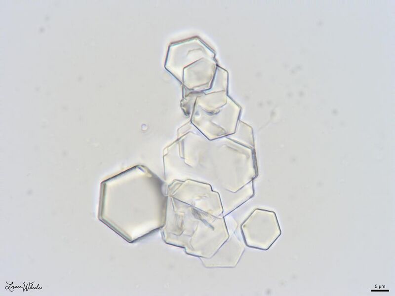 File:Cystine Crystals in Canine Urine Sediment.jpg