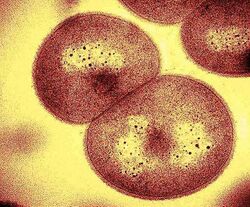 Deinococcus geothermalis cells.jpg