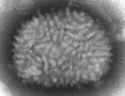 A TEM micrograp of "Vaccinia virus" virions