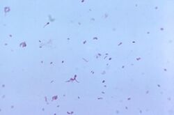 Clostridium tertium.jpg