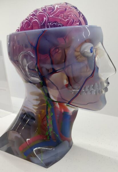 File:Material Jetted Model of a Human Skull.jpg