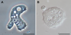 Parasite140120-fig3 Acanthamoeba keratitis.png