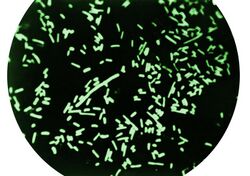 Dark field microscopy revealing Shigella dysenteriae bacteria.jpg