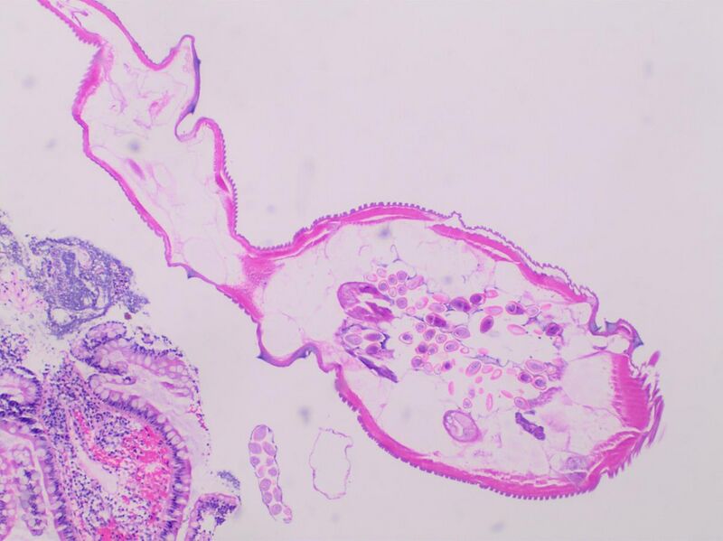 File:Enterobius vermicularis - intermediate magnification.jpg